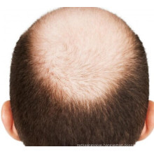 (Inositol Nf12) -- Prevent Hair Inositol